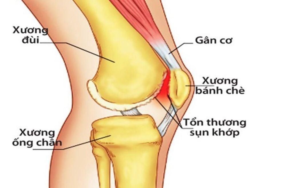 Đầu gối đóng vai trò quan trọng trong việc nâng đỡ trọng lượng cơ thể