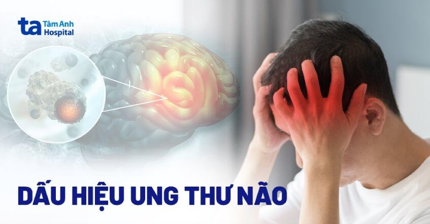 ung thư não