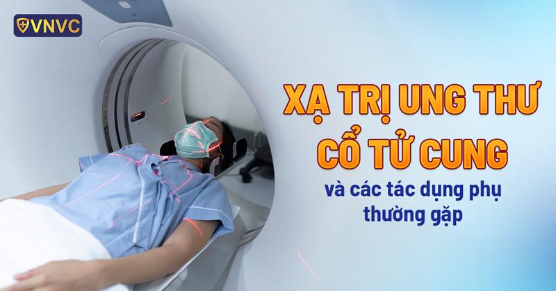 xạ trị ung thư cổ tử cung